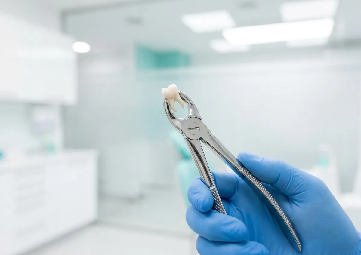 Tooth Extractions